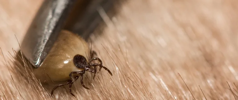 Tick removed with tweezers
